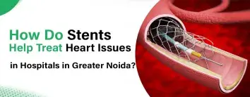 How Do Stents Help Treat Heart Issues in Hospitals in Greater Noida