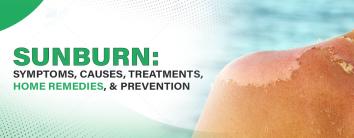 Types of Sunburn