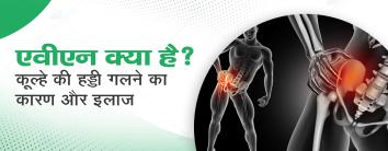 एवीएन क्या है