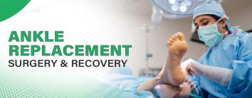 ankle-replacement