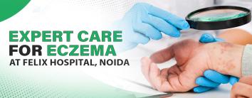 Expert Care for Eczema at Felix Hospital, Noida