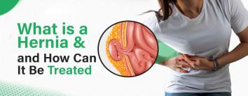 what-is-hernia