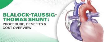 Best Hospital in Noida