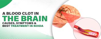Best Hospital in Noida