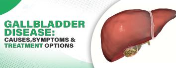 Understanding Gallbladder Disease: Causes, Symptoms, and Treatment Options