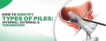 Best Hospital in Noida