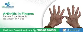 Arthritis in Fingers