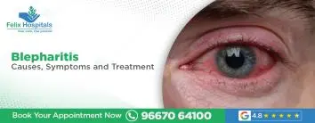 Blepharitis