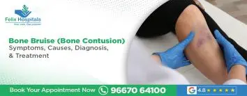 Bone Bruise (Bone Contusion)