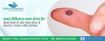 ब्लड ब्लिस्टर (Blood Blister) क्या होता है? कारण, लक्षण और उपचार