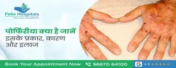 पोर्फिरीया क्या है जानें इसके प्रकार, कारण और इलाज