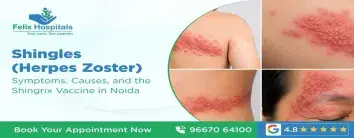 Shingles (Herpes Zoster): Symptoms, Causes, and the Shingrix Vaccine in Noida